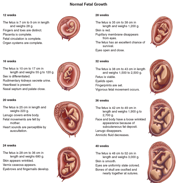 different presentation of fetus