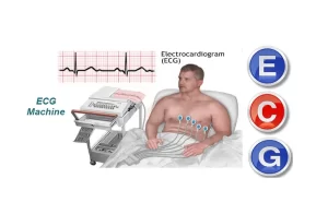 The electrocardiogram (ECG) 