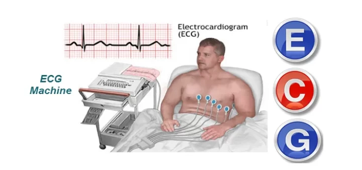 The electrocardiogram (ECG)