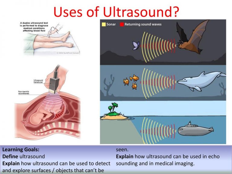 Sound Intensity, Factors Affecting Sound Intensity And Applications Of ...