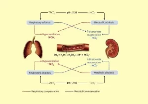 Acid-base disturbances