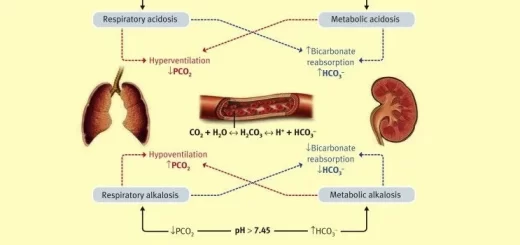 Acid-base disturbances