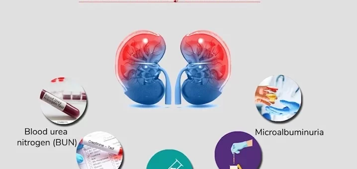 Tests to evaluate kidney function