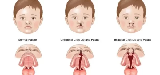 Abnormalities of the face