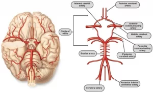 Circle of Willis