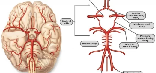 Circle of Willis