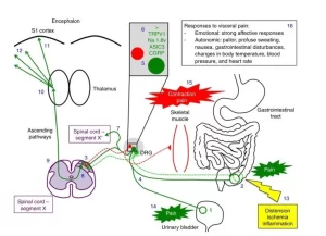 Effects of somatic pain & Visceral pain