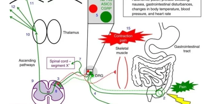 Effects of somatic pain & Visceral pain