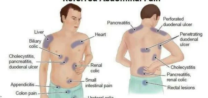 Referred pain