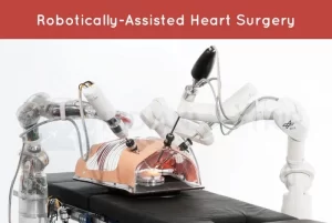 Robotic cardiac surgery