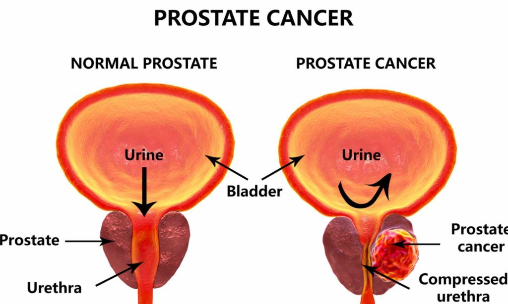 functions-of-the-prostate-gland-science-online