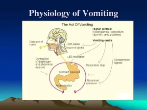 Vomiting mechanism