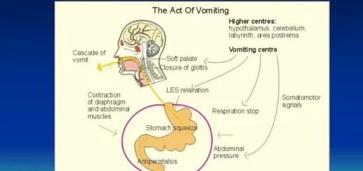 Vomiting mechanism