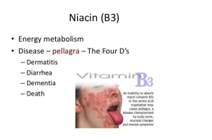 Vitamin B3 Niacin Deficiency (Pellagra)