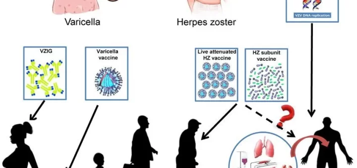 Life cycle of varicella zoster virus