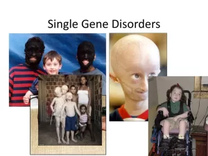 Single Gene Disorders