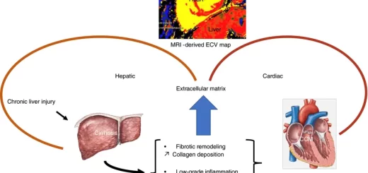 Cardio-Pulmonary problems in Liver Cirrhosis