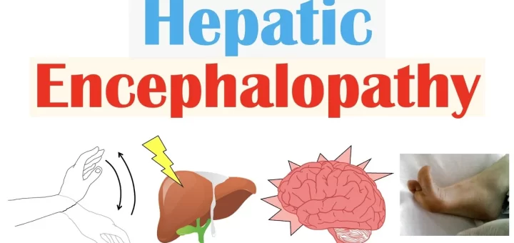 Hepatic Encephalopathy