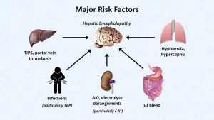 Minimal hepatic encephalopathy risks