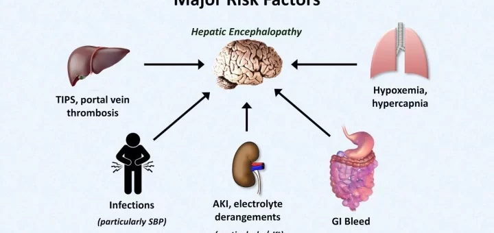 Minimal hepatic encephalopathy risks