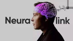 Neuralink 