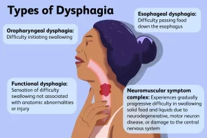 Dysphagia 