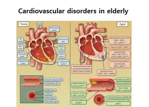 Cardiovascular disorders in elderly