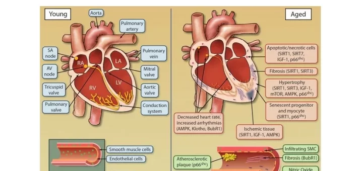 Cardiovascular disorders in elderly