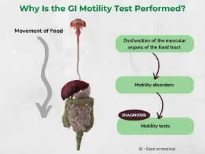 GIT Motility Disorders