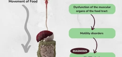 GIT Motility Disorders