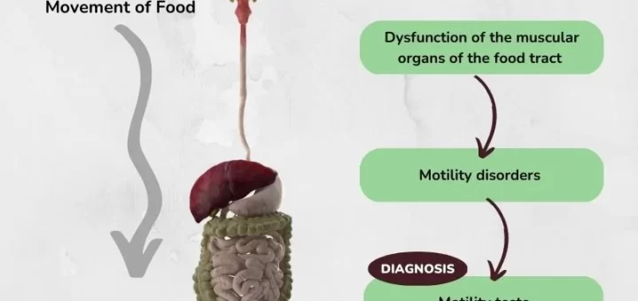 GIT Motility Disorders