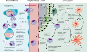 Whipple's disease symptoms, causes, treatment