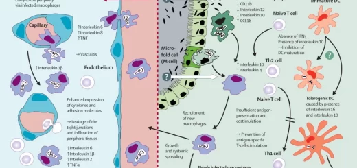 Whipple's disease symptoms, causes, treatment