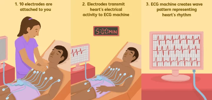 Electrocardiogram