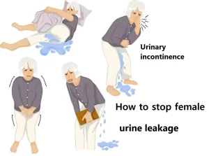 Urinary incontinence