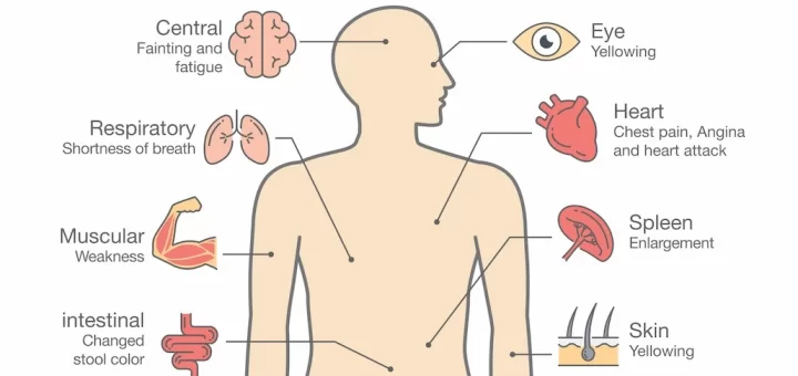 Anemia in elderly symptoms