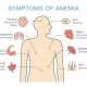 Anemia in elderly symptoms