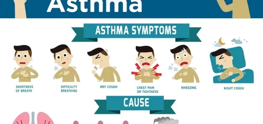 Asthma control