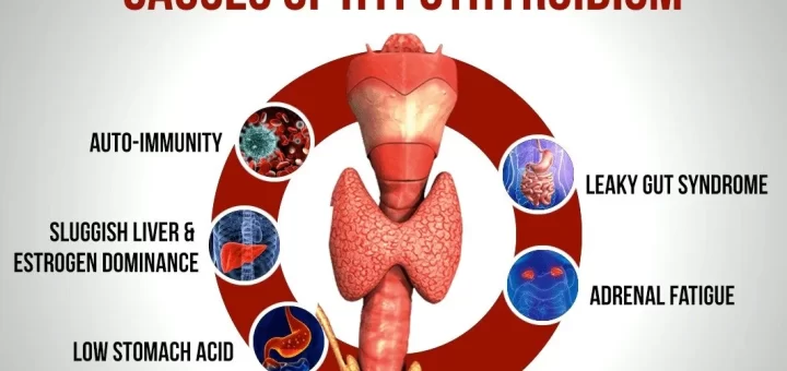 Hypothyroidism causes