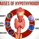 Hypothyroidism causes