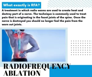 RFA for management of chronic back pain 